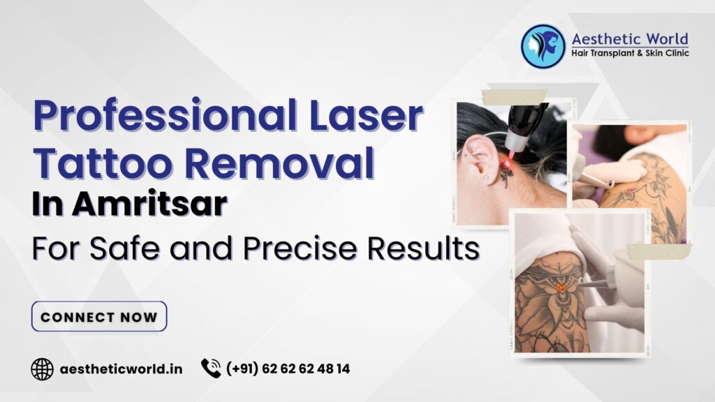 Laser Tattoo Removal in Amritsar